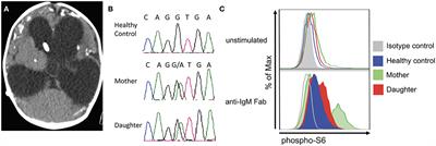 Disseminated and Congenital Toxoplasmosis in a Mother and Child With Activated PI3-Kinase δ Syndrome Type 2 (APDS2): Case Report and a Literature Review of Toxoplasma Infections in Primary Immunodeficiencies